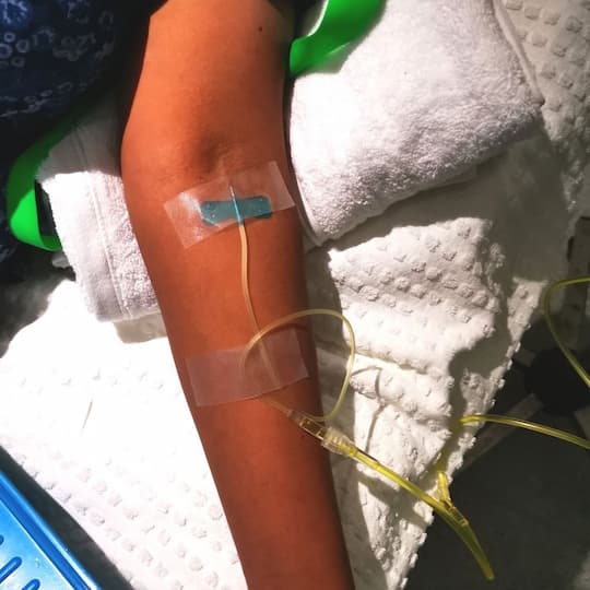 clearlift non surgical facelift